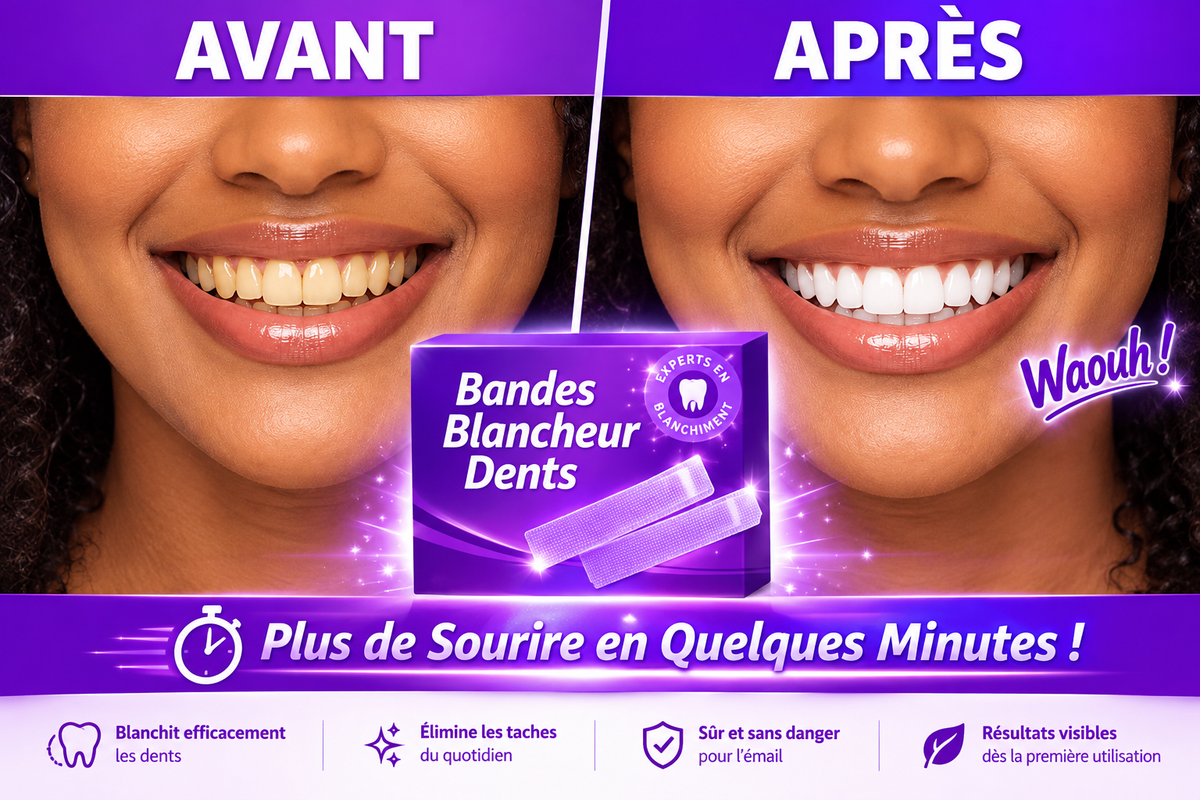 GlorySmile V34 Bandes de blanchiment dentaire ultra rapide — L'Éclat du Sourire ✨